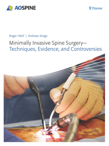 Minimally Invasive Spine Surgery: Techniques, Evidence, and Controversies