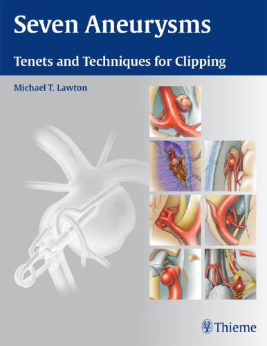 Seven Aneurysms: Tenets and Techniques for Clipping