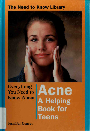 Everything You Need to Know About Acne
