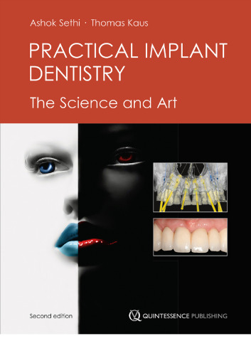 Practical implant dentistry: the science and art