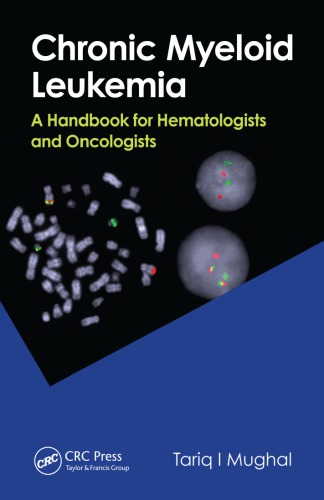Chronic Myeloid Leukemia: A Handbook for Hematologists and Oncologists