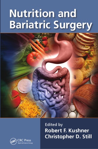 Nutrition and Bariatric Surgery