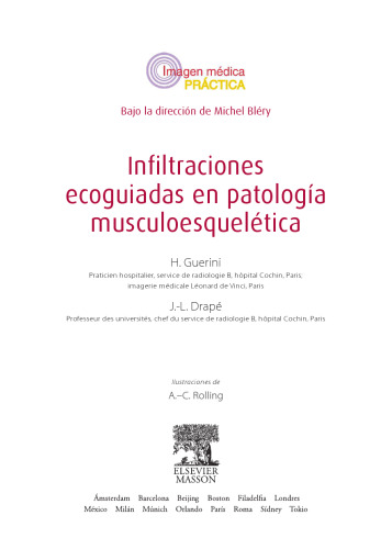 Infiltraciones Ecoguiadas en Patología Musculoesquelética