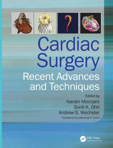 Cardiac Surgery: Recent Advances and Techniques