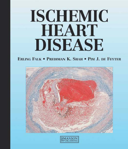 Ischemic Heart Disease
