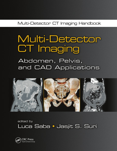 Multi-Detector CT Imaging: Principles, Head, Neck, and Vascular Systems