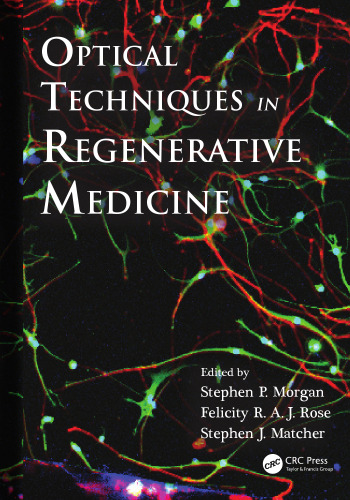 Optical Techniques in Regenerative Medicine