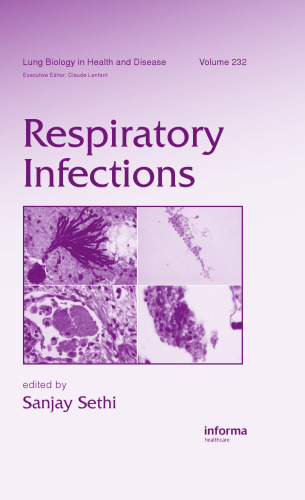 Respiratory Infections