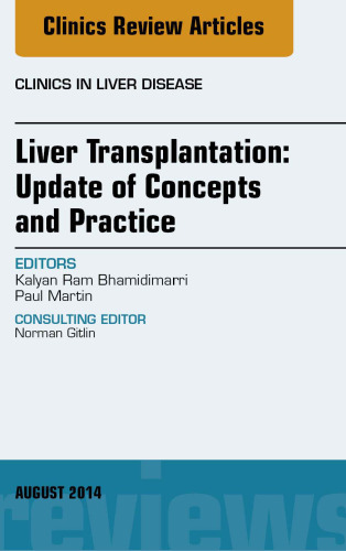 Liver Transplantation: Update of Concepts and Practice, An Issue of Clinics in Liver Disease, 1e