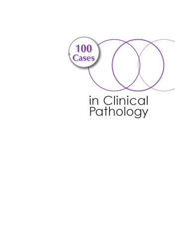 100 Cases in Clinical Pathology