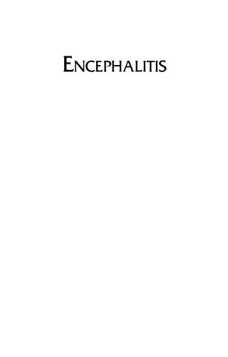 Encephalitis: Diagnosis and Treatment
