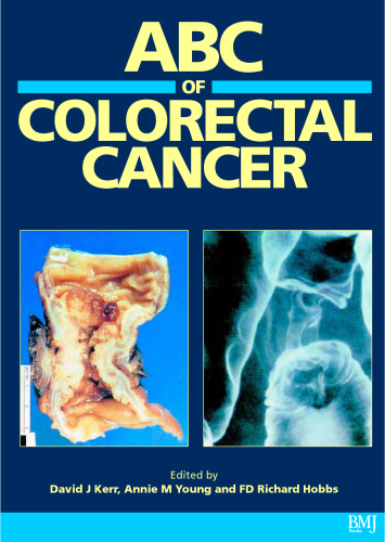 ABC of Colorectal Cancer
