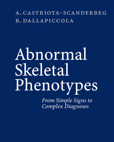 Abnormal Skeletal Phenotypes From Simple Signs to Complex Diagnoses