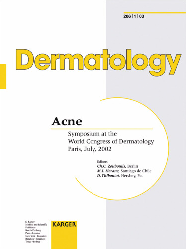 Acne Symposium at the World Congress of Dermatology