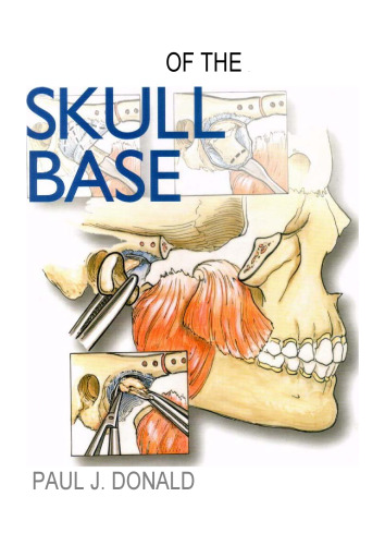 Surgery of the Skull Base