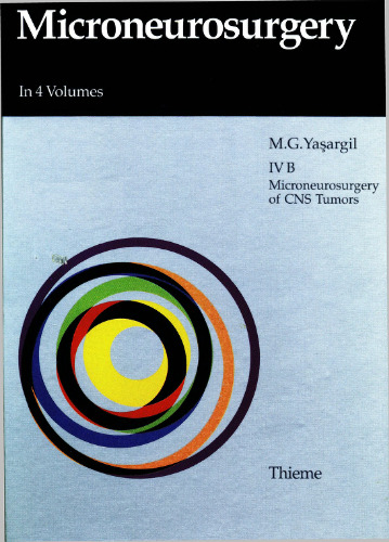 Microneurosurgery: Operative Treatment of CNS Tumors 4B