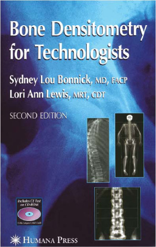 Bone Densitometry For Technologists