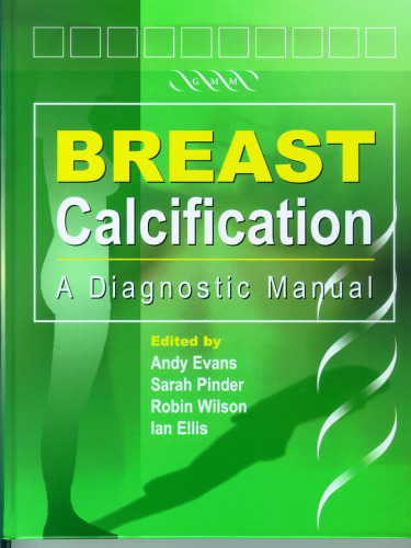 Breast Calcification- A Diagnostic Manual