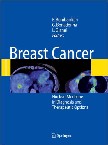 Breast Cancer Nuclear Medicine in Diagnosis and Therapeutic Options