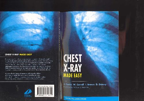 Chest X-Ray Made Easy