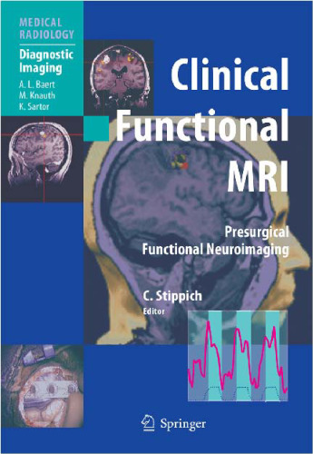 Clinical Functional MRI Presurgical Functional Neuroimaging