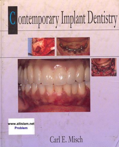 Contemporary Implant Dentistry