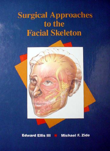 Surgical Approaches to the Facial Skeleton