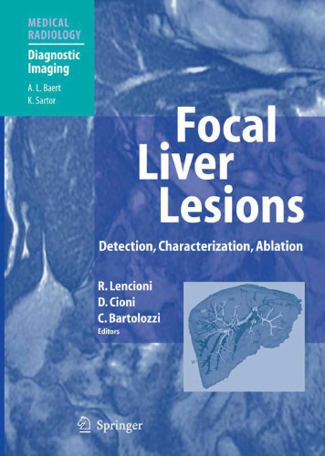 Focal Liver Lesions Detection, Characterization, Ablation