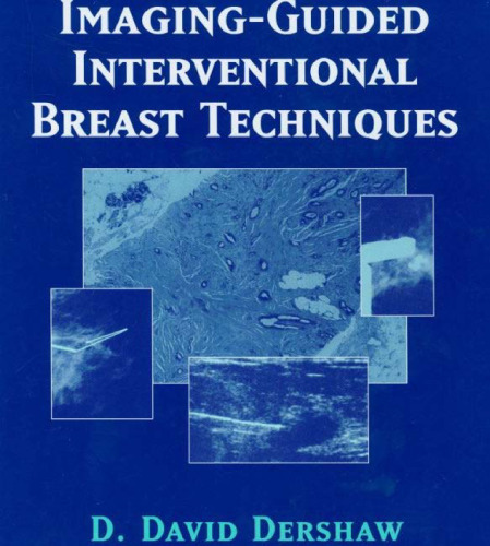 Imaging-Guided Interventional Breast Techniques