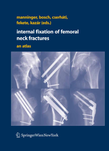 Internal fixation of femoral neck fractures An Atlas