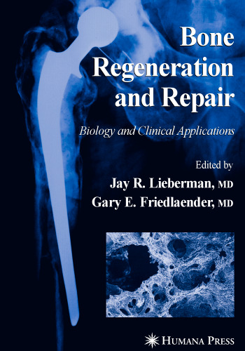 Lieberman Bone Regeneration and Repair-Biology and Clinical Applications