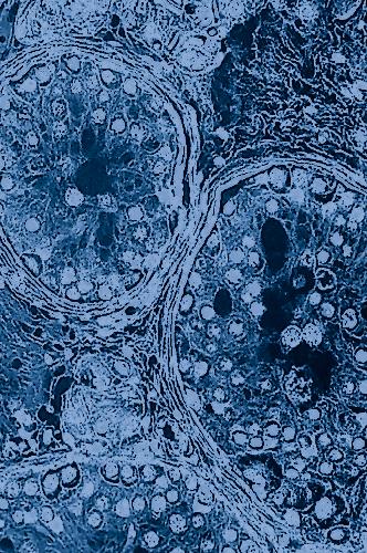 Male Hypogonadism. Contemporary Endocrinology