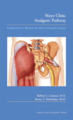 Mayo Clinic Analgesic Pathway Peripheral Nerve Blockade for Major Orthopedic Surgery