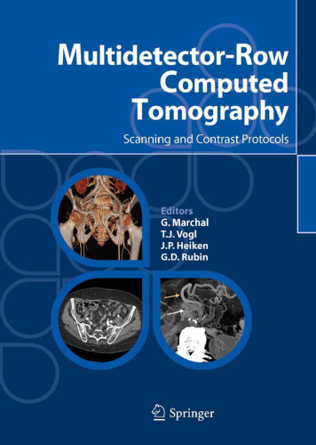 Multidetector-Row Computed Tomography Scanning and Contrast Protocols