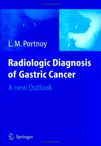 Radiologic Diagnosis of Gastric Cancer A new Outlook