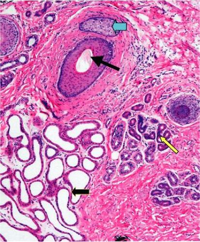 Sauer’s Manual of Skin Diseases