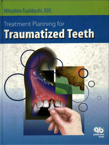 Treatment Planning for Traumatized Teeth