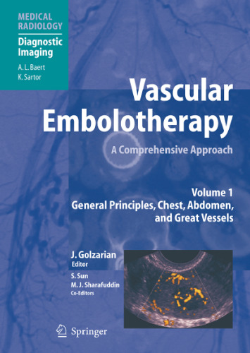 Vascular Embolotherapy A Comprehensive ApproachVolume 1 General Principles, Chest, Abdomen, and Great Vessels