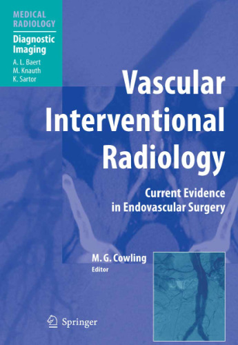 Vascular Interventional Radiology Angioplasty, Stenting, Thrombolysis and Thrombectomy