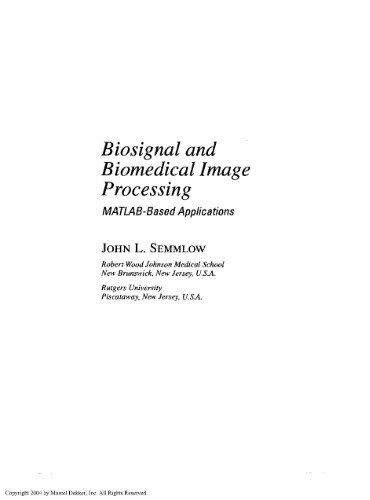 Biosignal and Biomedical Image Processing MATLAB based Applications - John L Semmlow