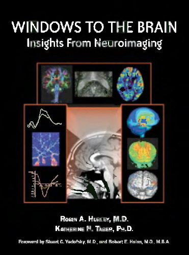 Windows to the brain : insights from neuroimaging