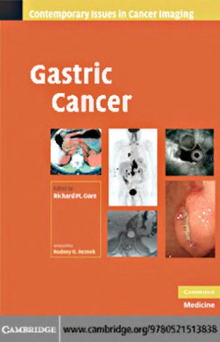 100 Q&A About Gastric Cancer (100 Questions & Answers about . . .) (100 Questions and Answers)