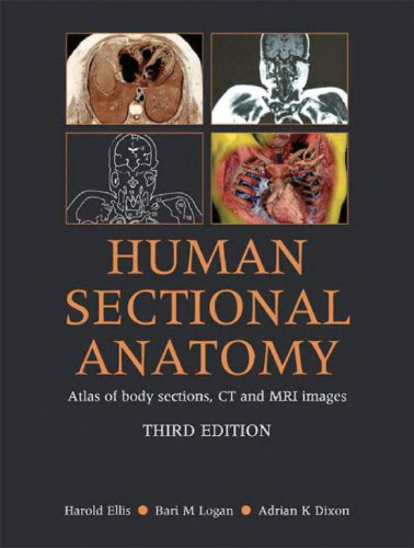 Human Sectional Anatomy: Pocket Atlas of Body Sections, CT and MRI Images