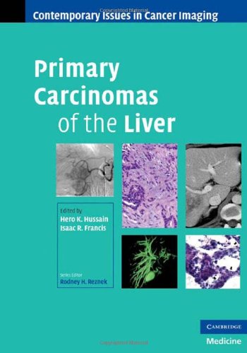 Primary Carcinomas of the Liver ()