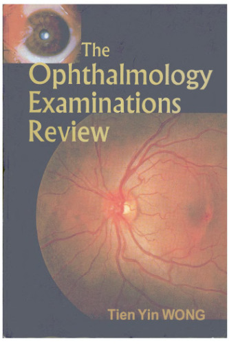 The Ophthalmology Examinations Review