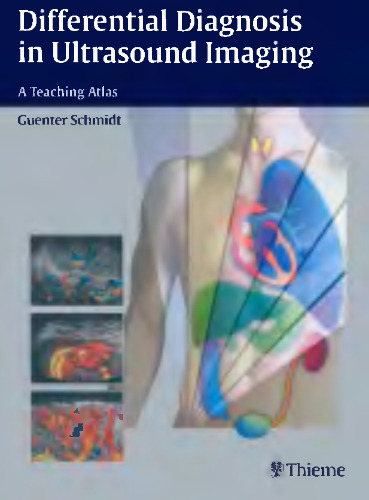 Differential Diagnosis in Ultrasound Imaging: A Teaching Atlas