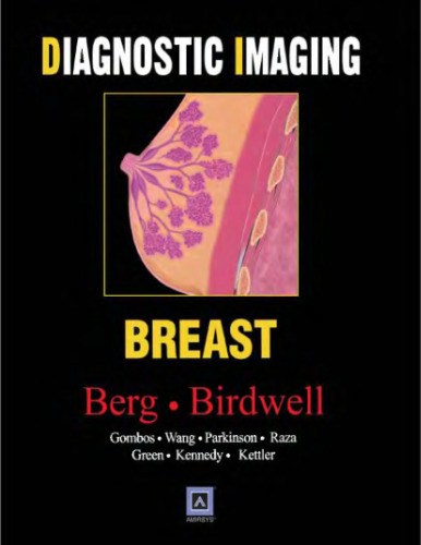 Diagnostic Imaging: Breast