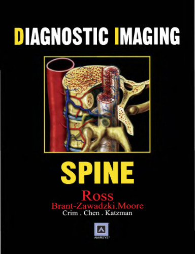 Diagnostic Imaging: Spine