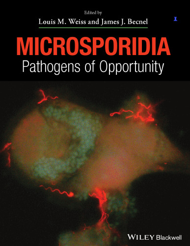 Microsporidia: Pathogens of Opportunity