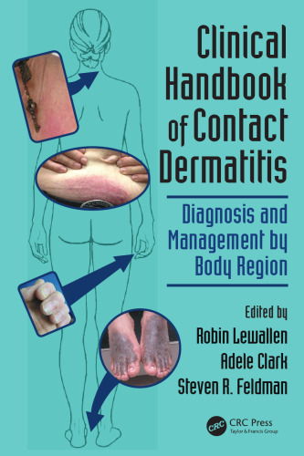 Clinical Handbook of Contact Dermatitis: Diagnosis and Management by Body Region